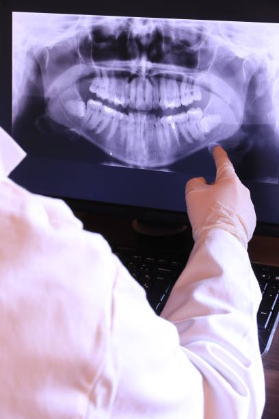 Best Emergency Root Canal Treatment in Budd Lake, NJ